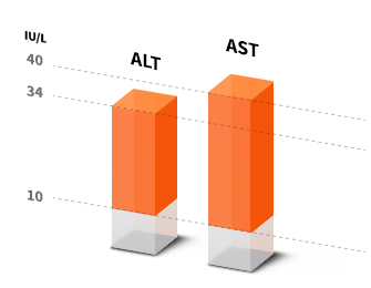 ALT&AST Chart