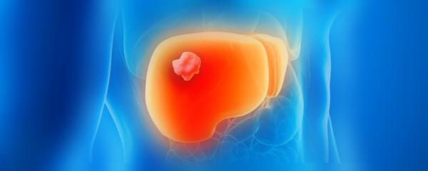 Reduce your chances of getting Liver Cancer (HCC)